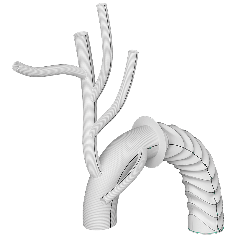 Image of Gelweave Trifurcate Arch Graft with Side Branch (Matalanis) on Thoraflex Hybrid