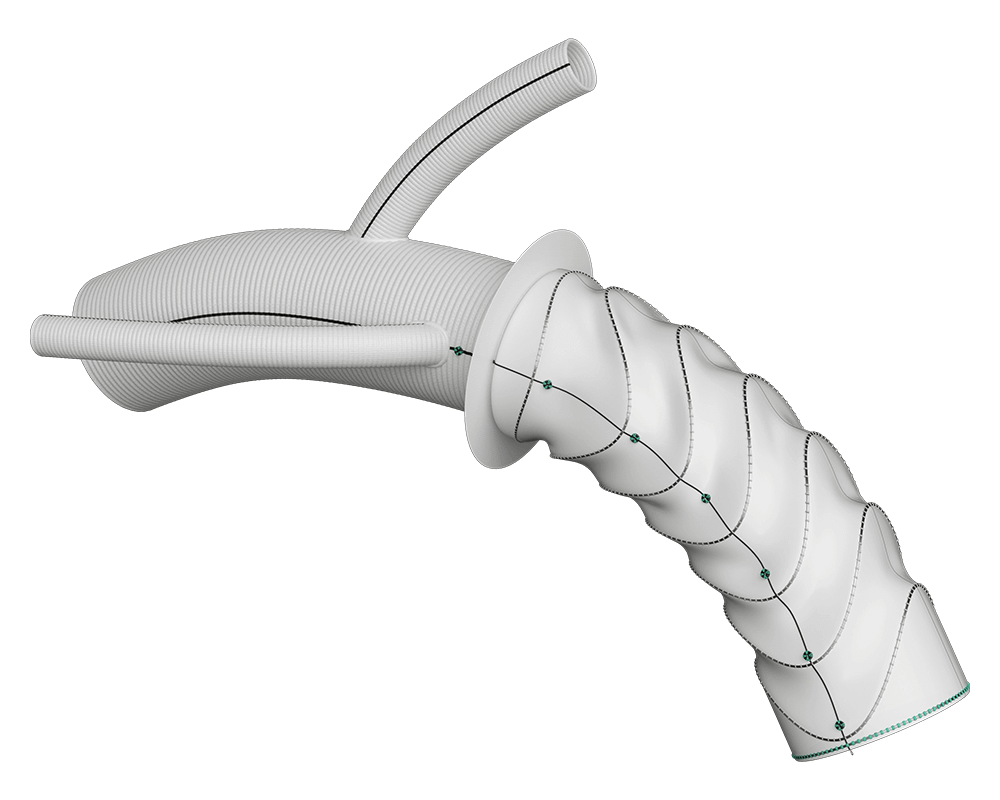 Thoraflex™ Hybrid (Custom Made) | Terumo Aortic