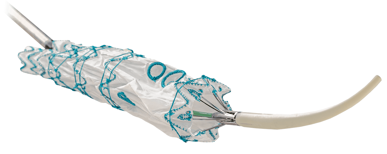 Fenestrated TREO Hero Image