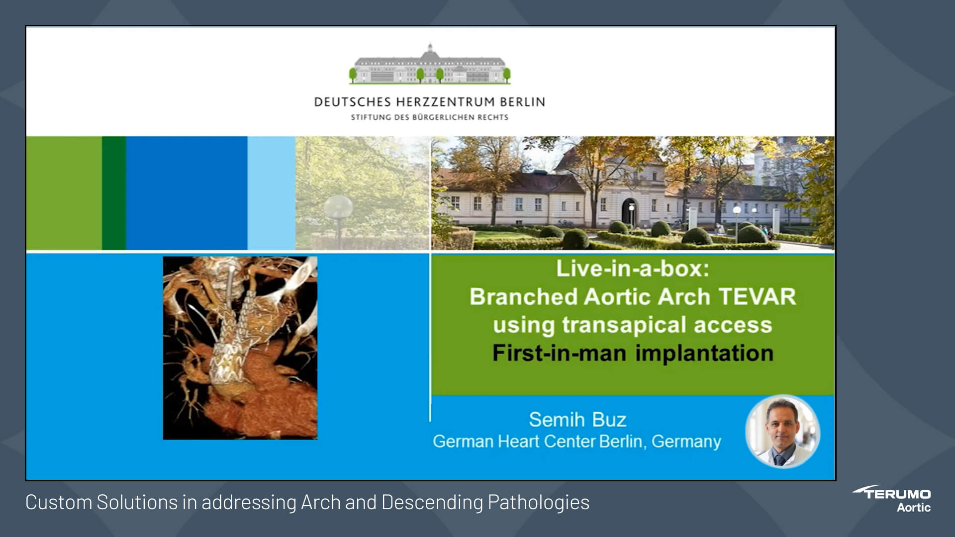 First in man RelayBranch transapical approach Terumo Aortic