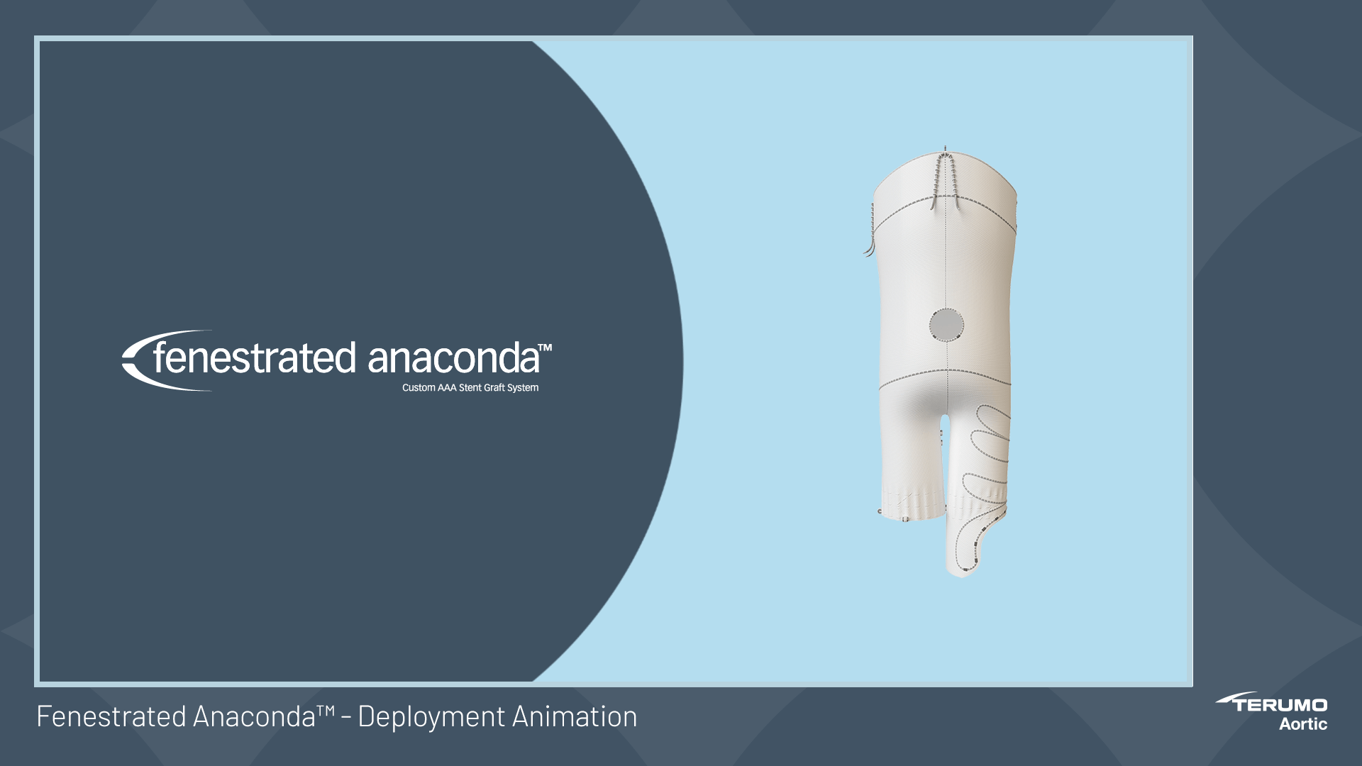 Fenestrated Anaconda Deployment Animation Terumo Aortic