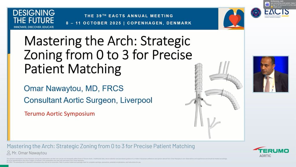 EACTS - Omar Nawaytou Thumbnail