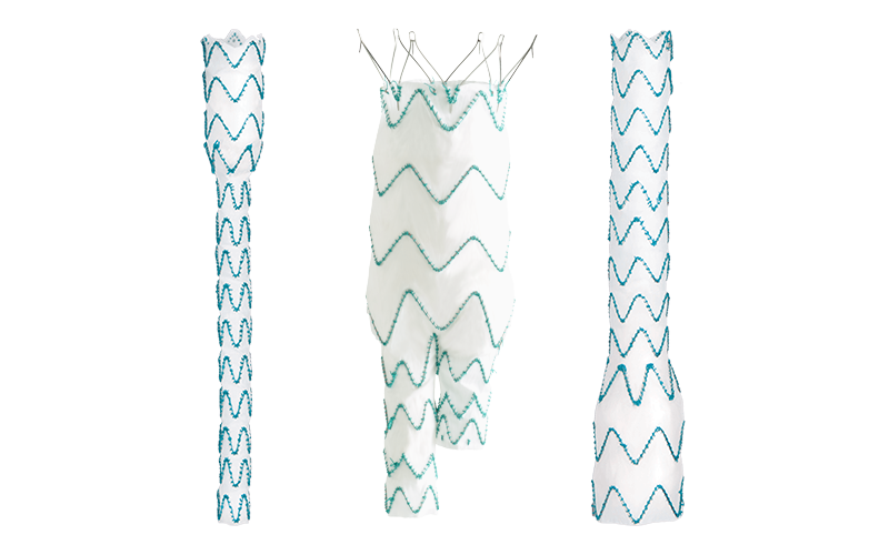 TREO 3 Piece Modular System (Update)